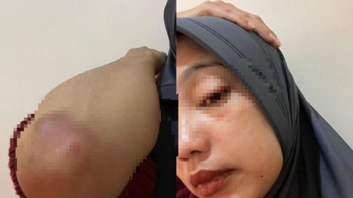 Kronologi Pak Kades selingkuh dengan mahasiswi KKN, istri sah curiga usai kena KDRT hingga laporkan ke polisi!