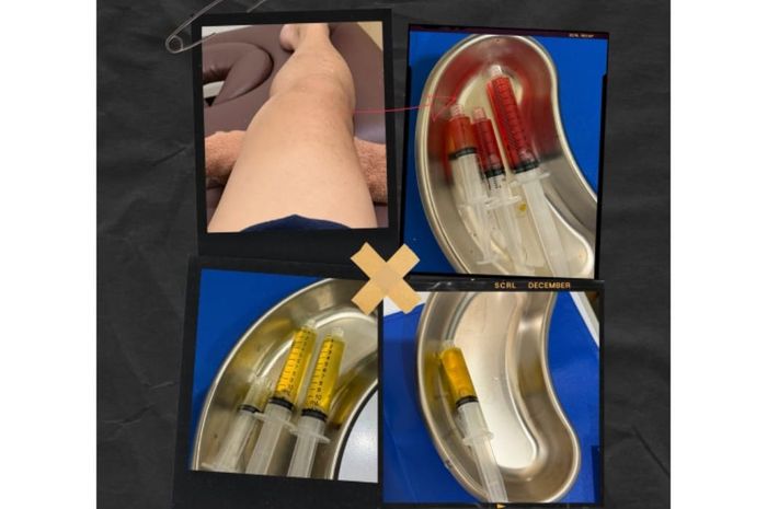 Ariel NOAH menjelaskan tentang cedera lutut yang dialaminya