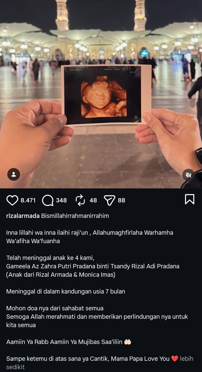 Anak keempat Rizal Armada meninggal dunia di dalam kandungan usia 7 bulan.