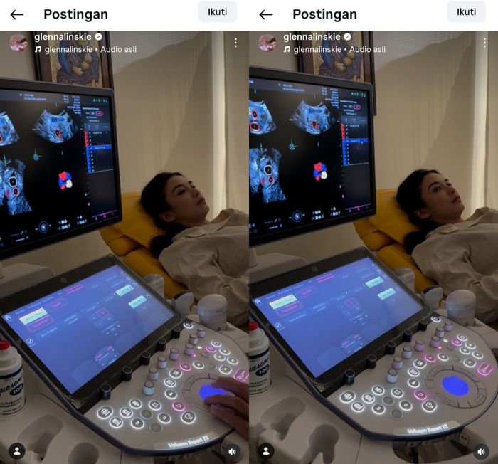 Glenn Alinskie mengunggah video saat Chelsea Islam melakukan pemerikaaan rahim. 