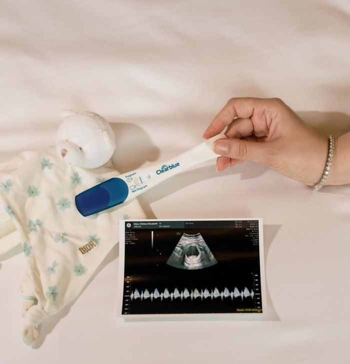 Unggahan kehamilan Chelsea Islan.