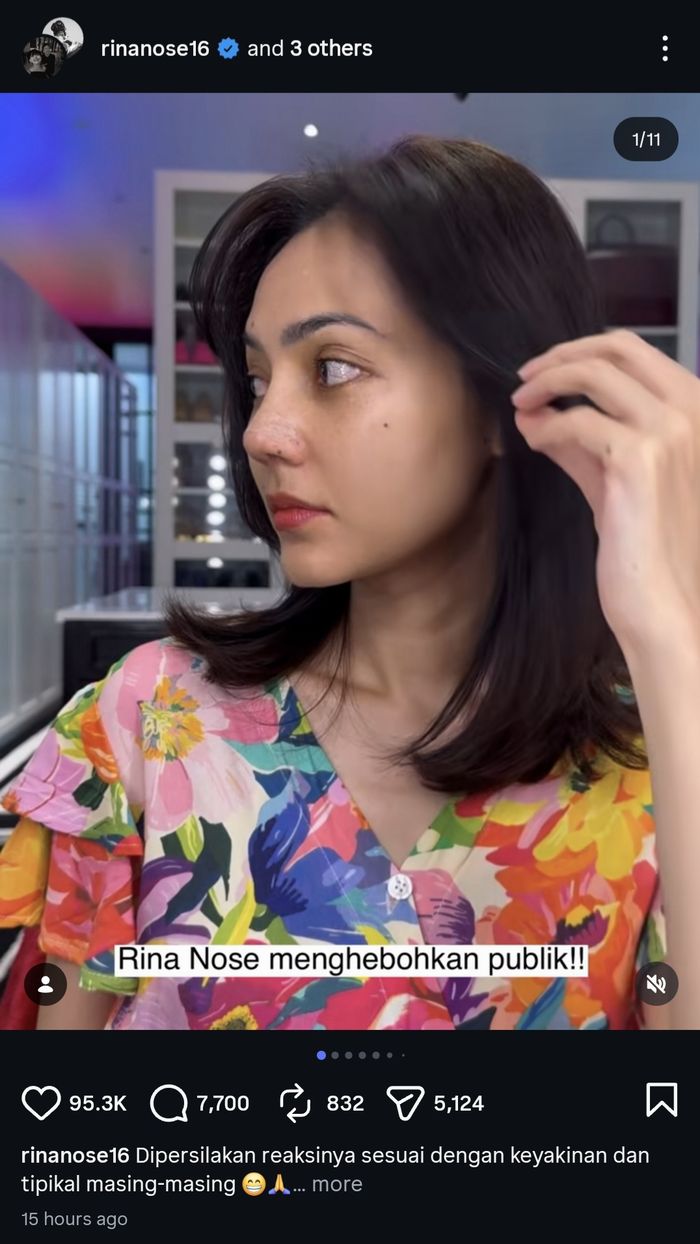 Rina Nose umumkan lakukan operasi plastik