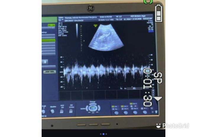 Adinda Thomas mengumumkan kabar bahagia mengenai kehamilan anak pertamanya bersama sang suami, Raka Akmal.