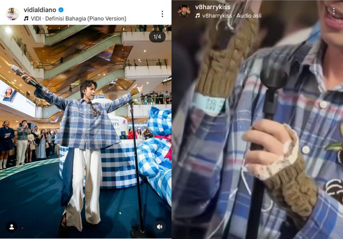 Ayah Vidi Aldiano ungkap alasan dibalik sarung tangan yang digunakan anaknya saat manggung.