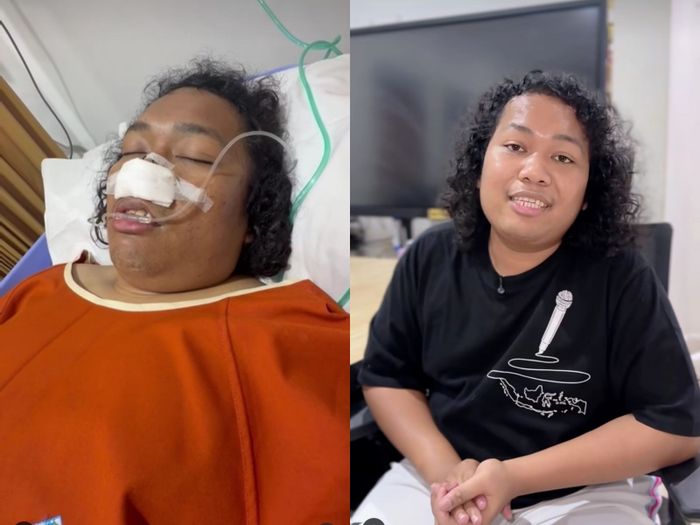 Marshel Widianto kini memilih batasi jam kerja usai kondisi kesehatannya sempat drop.