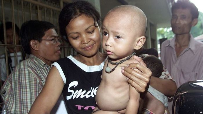 Seorang ibu bernama Dangati membawa bayinya berusia 18 bulan yang menderita gizi buruk ke sebuah rumah sakit.