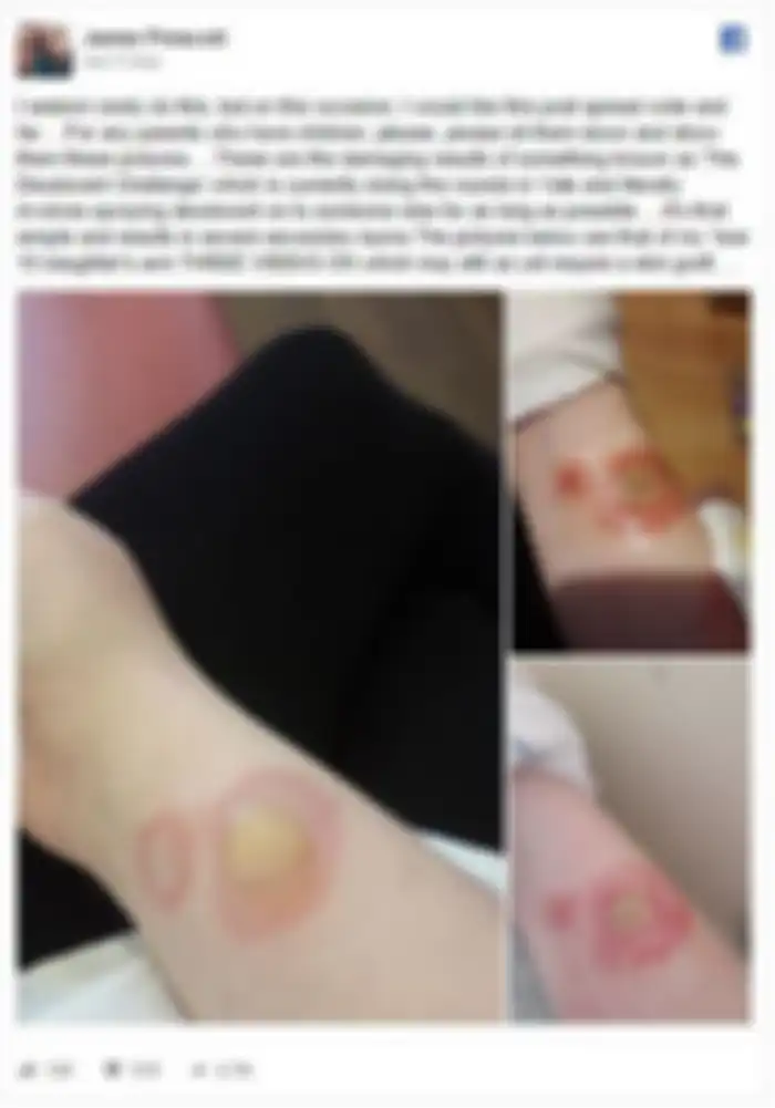 Akibat tantangan deodoran