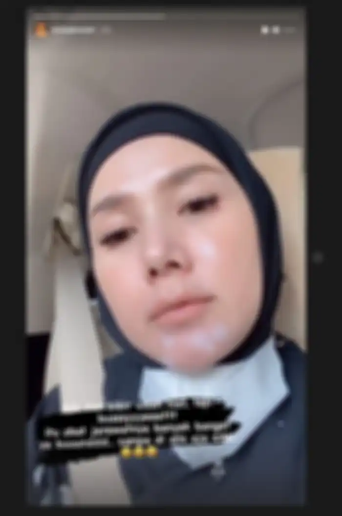 Mulan Jameela saat memamerkan mukanya yang tengah berjerawat