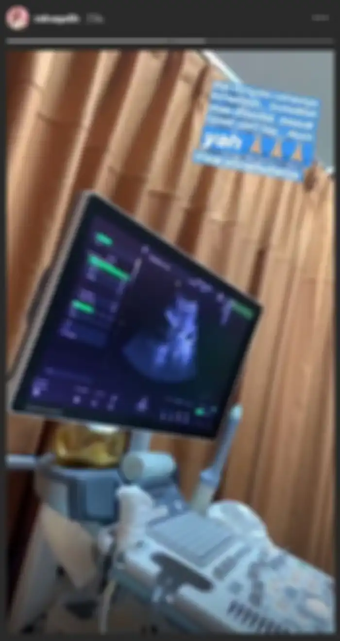Bak Hamil 8 Bulan, Mantan Kekasih Raffi Ahmad Ini Perutnya Membengkak Penuh Cairan 