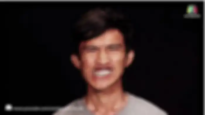 Monlin sebelum operasi.