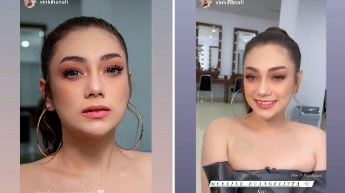 Kondisi tato Celine Evangelista 