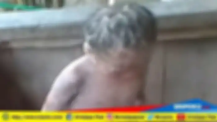 Bocah 5 tahun memiliki kulit bersisik sejak lahir