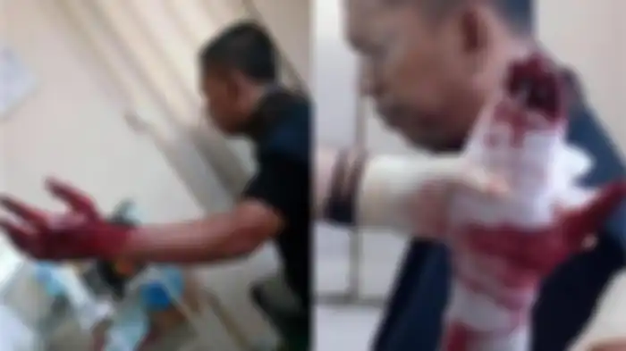 NS menjadi korban pembacokan debt collector