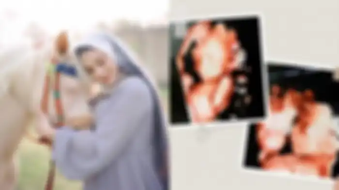 Bayi Kembar Meninggal Dunia, Irish Bella Disebut Alami Mirror Syndrome, Simak Penyebab dan Gejalanya.  