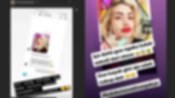 Irma Darmawangsa komentari Barbie Kumalasari yang sulam bibir