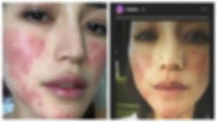 Kondisi kulit Jedar pascaperawatan 