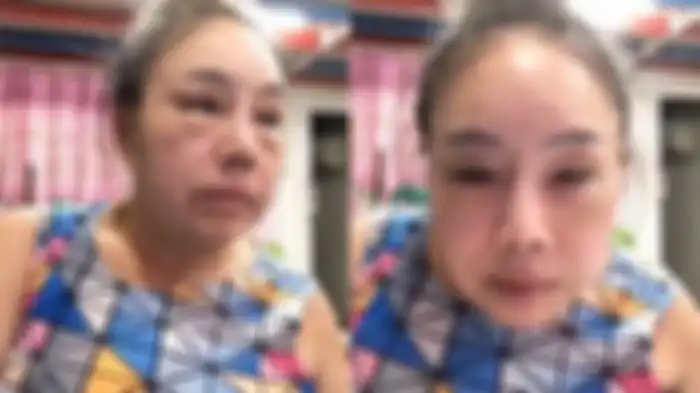 Leena Jung lakukan deformasi wajah