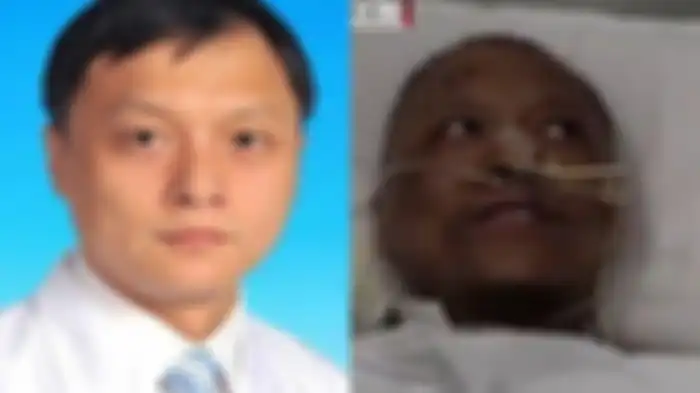 Dr Yi Fan (foto di sebelah kiri sebelum jatuh sakit) setelah terinfeksi Covid-19