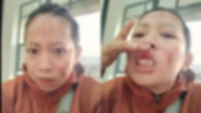 Viral, hanya karena tanya jatah sembako, wanita ini dihajar Bu RT hingga babak belur.