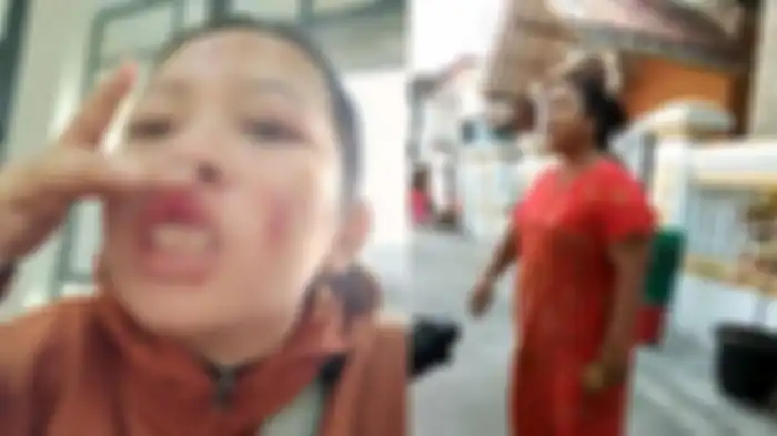 Nur, wanita yang dihajar ibu RT gara-gara bertanya soal sembako