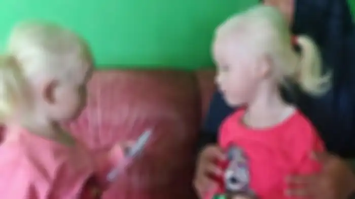 Anak kembar albino di Wonogiri