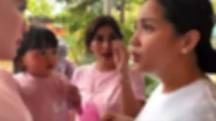 Wajah anak Syahnaz lebam karena terjatuh