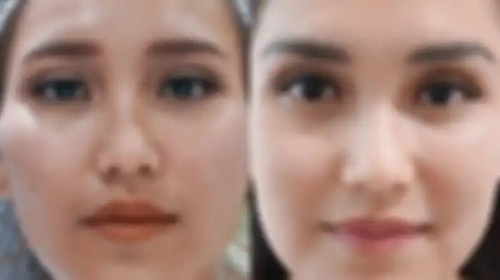 Wajah Ayu Ting Ting sebelum dan sesudah dipermak  