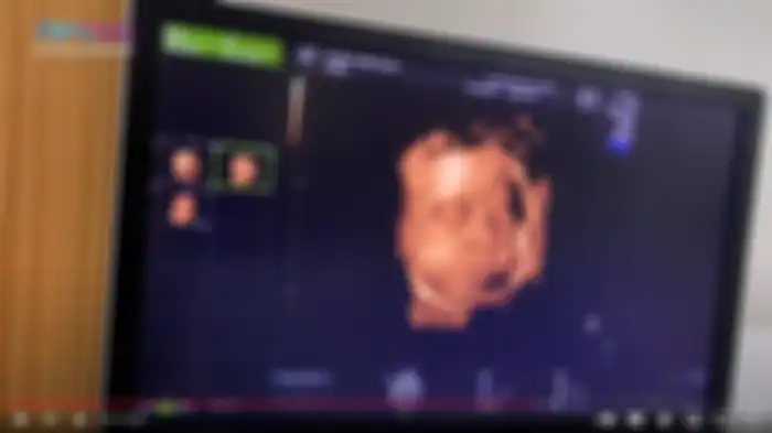 Nagita Slavina kaget melihat USG calon anak keduanya mirip Rafathar. 