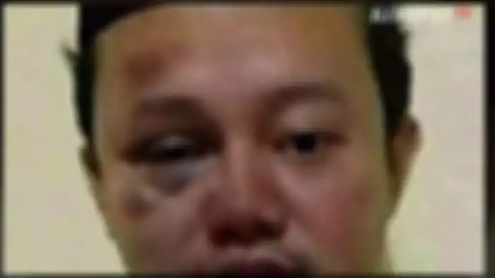  viral foto Herry Wirawan, pemerkosa 12 santriwati lebam-lebam pasca masuk penjara 