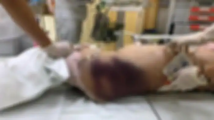 Kondisi tragis korban saat dibawa ke rumah sakit 