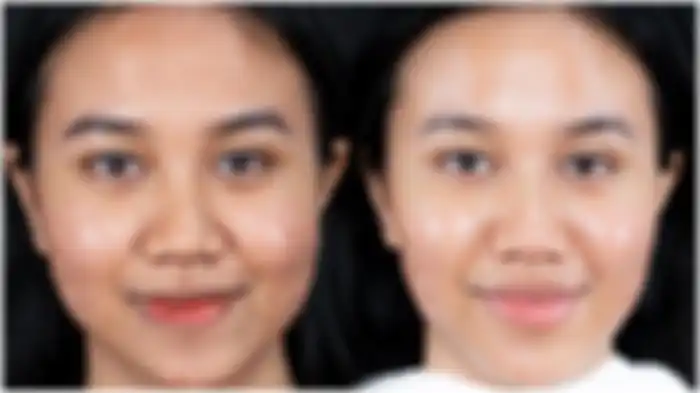 Transformasi Mayang sebelum dan sesudah perawatan wajah.