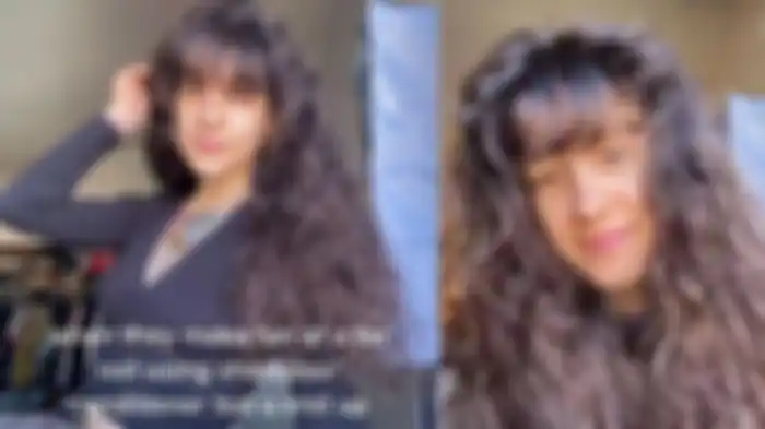 Kondisi rambut Laura Ashley