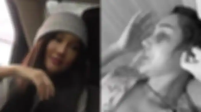 Wajah Lucinta Luna lebam