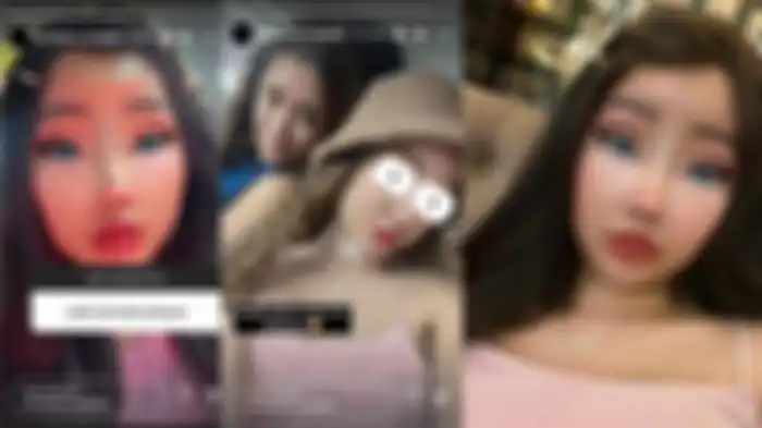 Lucinta Luna Pamer Wajah Terbaru Habis Operasi
