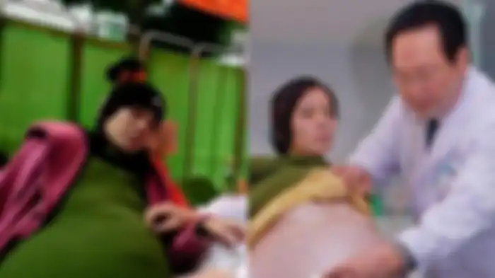 Peng Ximei ternyata derita tumor di ovarium 