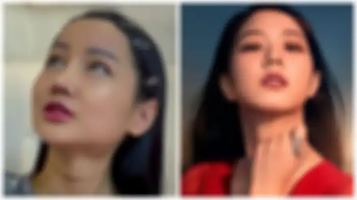 Lucinta Luna (kiri) dan Jisoo BLACKPINK (kanan) - Lucinta Luna merasakan sangat sakit di beberapa bagian saat operasi plastik. 