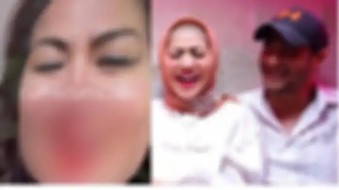 Venna Melinda dan Ferry Irawan.