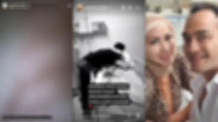 kondisi terkini Venna Melinda berangsur membaik 