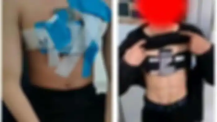 Viral di TikTok, peserta pria UTBK 2023 tertangkap tangan curang, yakni perekam kamera, audio visual serta handphone ditempel di dada. 