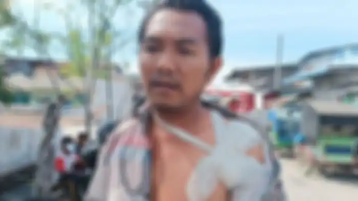 Ilyas tukang Becak Motor (Bentor) yang dibacok begal di Medan