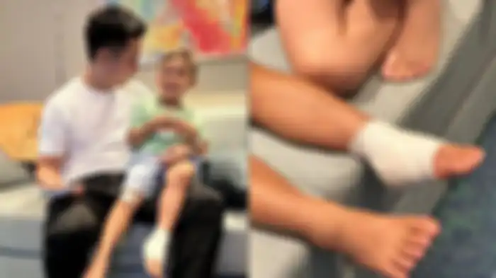 Unggahan Instagram Baim Wong saat Kiano mengalami insiden hingga harus jalani operasi kaki. 