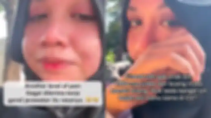 Wanita curhat lamaran kerjanya ditolak HRD gara-gara jerawatan 