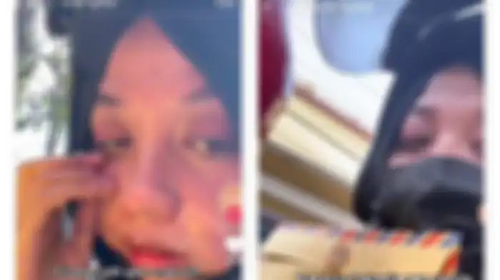 Kisah wanita yang ditolak HRD lantaran wajah berjerawat. 