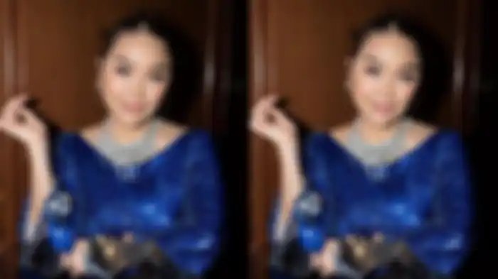 Hasil operasi anti aging Titi DJ 
