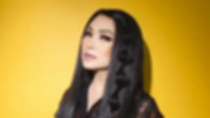 Hasil operasi anti aging Titi DJ 