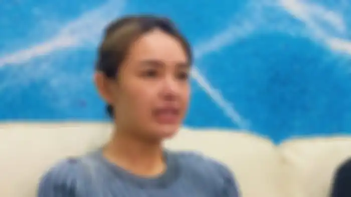 Amanda Manopo tepis dirinya lakukan operasi plastik tetapi karena berat badan turun, wajahnya agak berubah.
