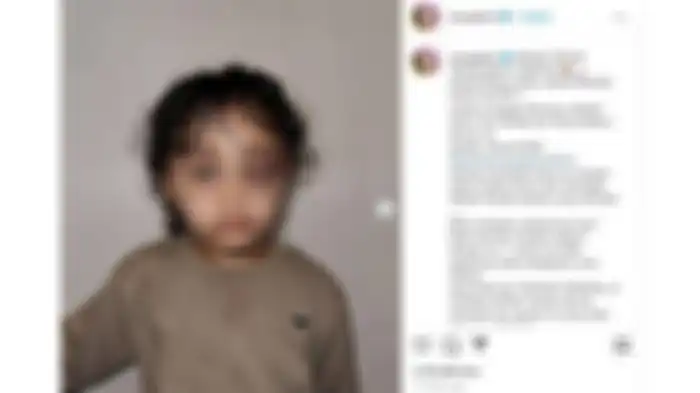 Anak selebgram Aghnia Punjabi diduga dianiaya oleh pengasuhnya. 
