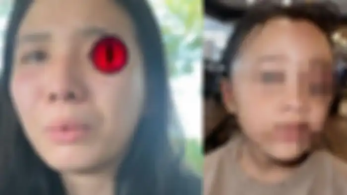 Tampang memelas pengasuh (kiri) yang menyiksa anak selebgram Aghnia Punjabi (kanan) hingga bonyok jadi sorotan.