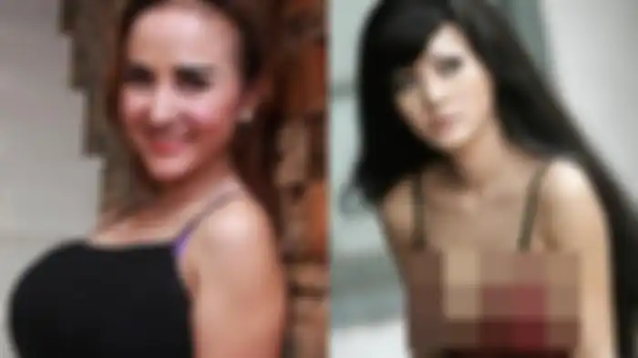 Cynthiara Alona sebelum dan sesudah operasi plastik