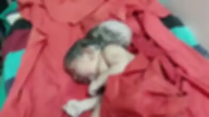 Bayi perempuan malang itu lahir dengan tiga kepala setelah ibunya mengeluhkan rasa sakit sebelum melahirkan